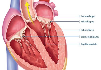 Erkrankungen der Herzklappen